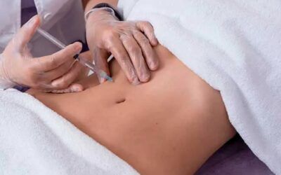 ¿Qué tan buena es la carboxiterapia? Descubre sus beneficios y resultados