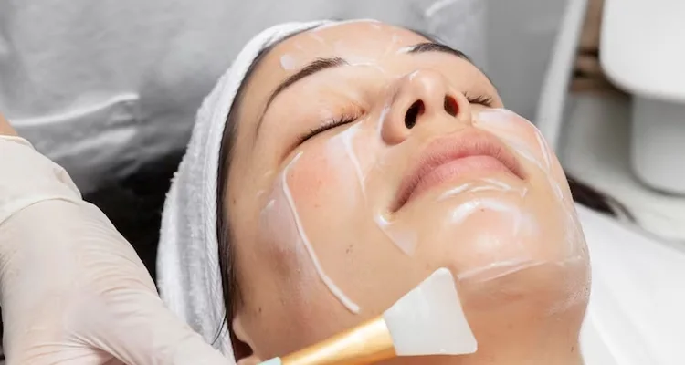 Tratamientos para acné bio peeling