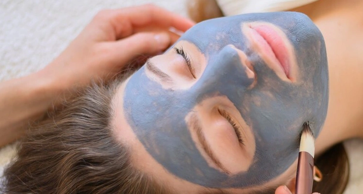 Tratamientos para acné carbon peel