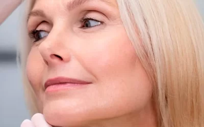 Cómo hacer una biorrevitalización facial con mascarilla de miel