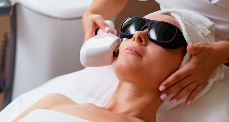 Fotoenvejecimiento laser facial