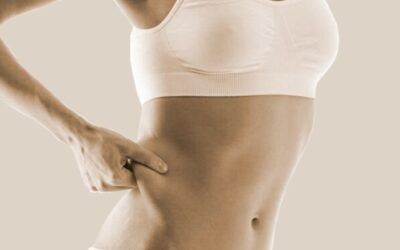 Mesoterapia: La Solución Innovadora para una Estética Corporal Perfecta